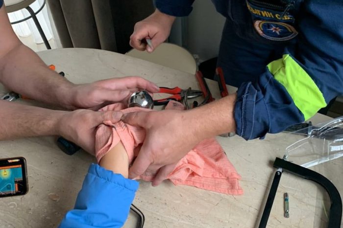 Застрял. Оренбургские спасатели освободили руку ребенка из дверной ручки